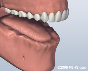 A mouth that has all teeth missing on its lower jaw