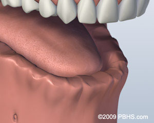 A digital representation of the lower jaw missing all of its teeth
